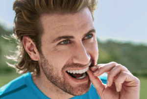 Read more about the article Benefits of Orthodontic Treatment